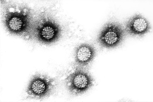 Ihmisen papilloomavirus